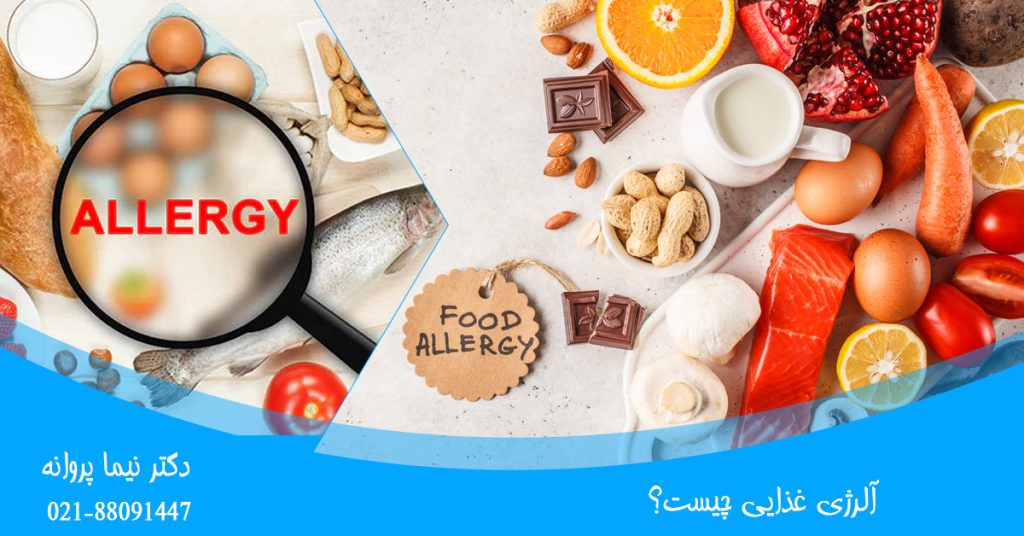 آلرژی غذایی