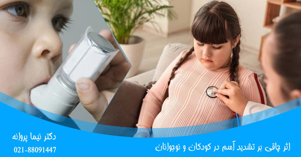 اثر چاقی بر تشدید آسم در کودکان و نوجوانان
