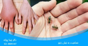 حساسیت به نیش زنبور